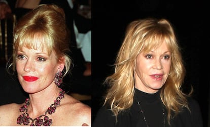 Melanie Griffith ha reconocido ser una adicta a los retoques estéticos.