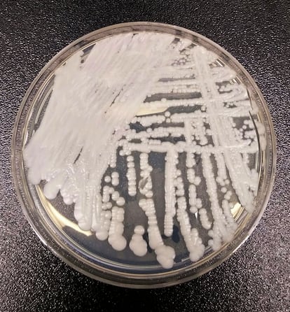 This undated photo made available by the Centers for Disease Control and Prevention shows a strain of Candida auris cultured in a petri dish at a CDC laboratory.