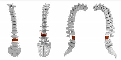 Reconstrucción de la columna vertebral del chico de Torrenueva.