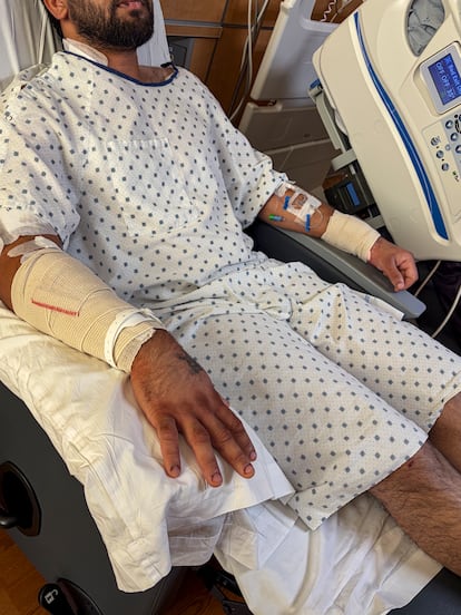 Heridas de Gurvinder Singh.