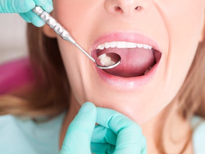 Una funda dental para dormir bien protagoniza el primer éxito español en el Tribunal Unificado de Patentes