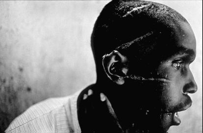 Premio World Press Photo 1994. El fotògraf nord-americà James Nachtwey, de l'agència Magnum Photos, va obtenir el guardó amb la seva imatge 'Hutu mutilat', que reflecteix la crueltat de la guerra civil a Ruanda a principis dels noranta en la qual van morir centenars de milers de persones.