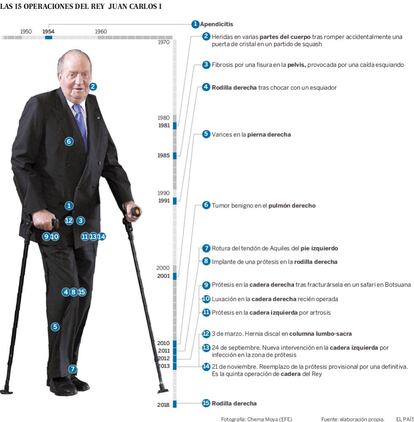 Las 15 operaciones de don Juan Carlos.