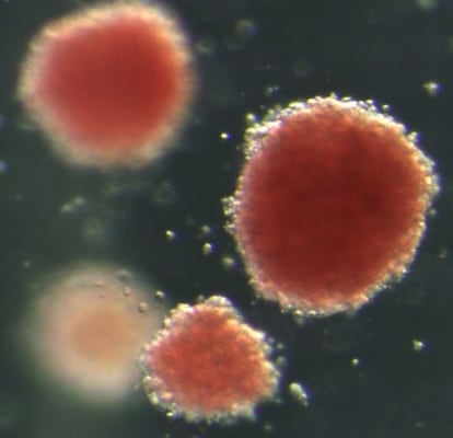 Cultivo de góbulos rojos obtenidos de células madre.