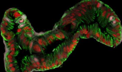 Intestino generado a partir de células madre.