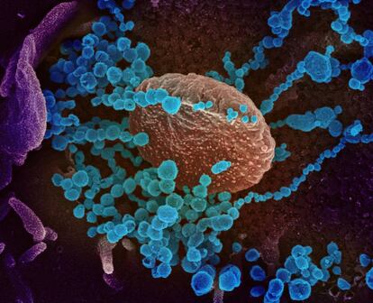 Esta imagen de microscopio electrónico de barrido muestra el SARS-CoV-2 (coloreado en azul) emergiendo de la superficie de células cultivadas en laboratorio.