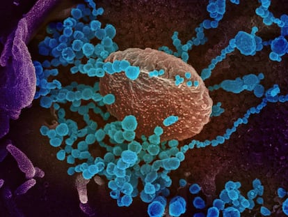 Esta imagen de microscopio electrónico de barrido muestra el SARS-CoV-2 (coloreado en azul) emergiendo de la superficie de células cultivadas en laboratorio.
 
 