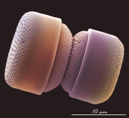 Esta imagen bajo el nombre ‘Nanoplancton calcáreo’ es fruto de un experimento sobre el impacto del calentamiento y la acidificación del Mediterráneo en el que se pretende averiguar si la estructura del nanoplancton calcáreo (fitoplancton, cocolitóforos) está dañada o se mantiene intacta.