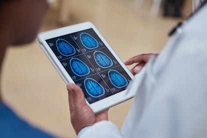 Infartos cerebrales en África