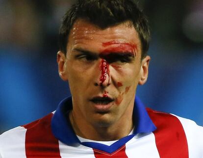 Mandzukic, sangrando tras un encontronazo con Ramos