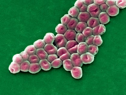 Una imagen generada por microscopio electrónico del 'Acinetobacter baumannii', un tipo de bacteria que parece capaz de oponer resistencia a los antibióticos disponibles.