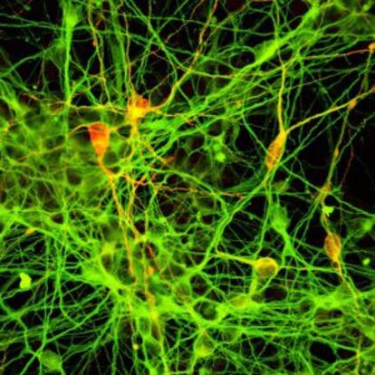 Neuronas derivadas de c&eacute;lulas madre iPS.