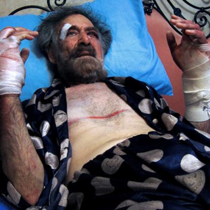 Ali Ferzat se recupera de la agresión, el jueves en su domicilio de Damasco.