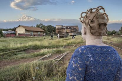 Grace, tanzana y albina, mira al nevado Kilimanjaro. Es la foto que abre el libro 'Albino'. Para mí es una imagen simbólica porque Tanzania es un país en el que conviven 40 millones de personas de más de cien tribus distintas donde se hablan 127 idiomas. Es un destino turístico habitual y, precisamente en las faldas de esta montaña, es también donde se concentra la mayor comunidad albina de África.