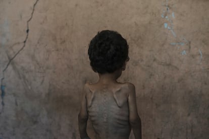 Guerra en Gaza