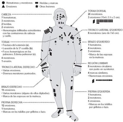 Autopsia al cadáver de Juan Martínez Galdeano.