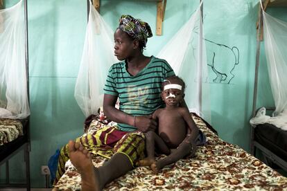 Soucoura, 24 meses, aquejada de malnutrición severa y malaria, se sienta junto a su madre Nia Marico, de 28 años, en la Unidad Nutricional Intensiva Alima-AMCP del hospital Dioila el 7 de noviembre de 2016 en Dioila, Malí. 