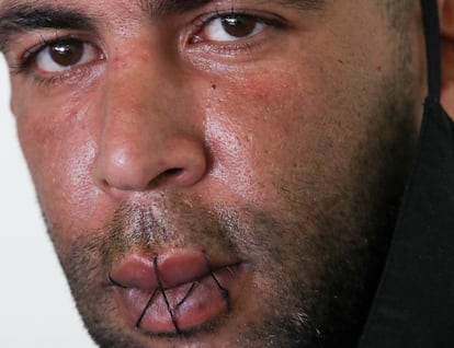 Mohamed Lamine, solicitante de asilo proveniente de Argelia, también se ha cosido los labios en el marco de la huelga de hambre para reclamar su legalización.