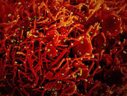Partículas de vírus SARS-CoV-2 (em amarelo) infectando uma célula apoptótica, colorida de vermelho.