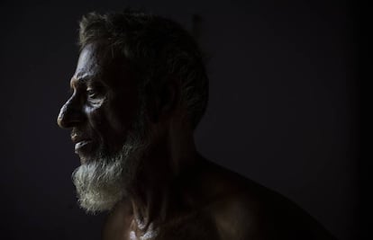 Shahaz Uddin también ha bebido agua contaminada con arsénico.