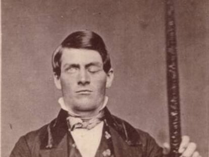 Phineas Gage junto a la barra que le atravesó el cerebro y cambió su personalidad.