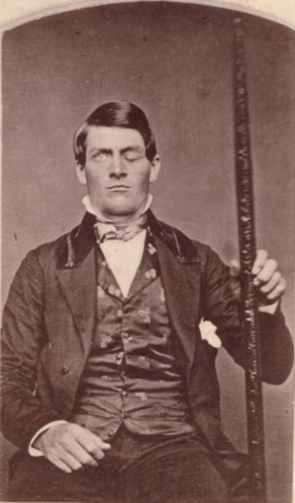 Phineas Gage junto a la barra que le atravesó el cerebro y cambió su personalidad.