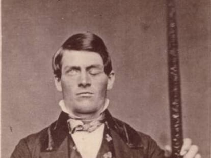 Phineas Gage junto a la barra que le atravesó el cerebro y cambió su personalidad