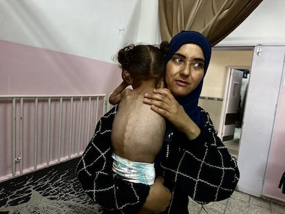 Mayar El Arca, de 18 meses, recibe atención médica por malnutrición en el Hospital Nasser de Jan Yunus, el 17 de mayo.
