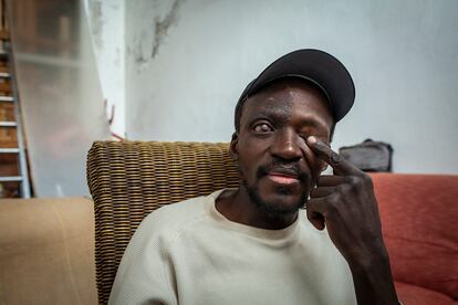 Issouf perdió la visión del ojo derecho tras sufrir un accidente laboral
en el campo. Desde entonces vive en Lepe y trabaja en los campos de fresa y arándano.