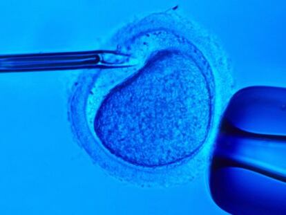 Proceso de fecundaci&oacute;n asistida.