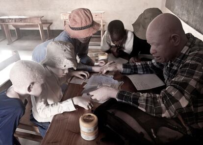 Distribución de la crema KIlisun en la Mwisenge Primary School, en Musoma, Tanzania. El reparto forma parte del Albino Outreach Project, un proyecto que arrancó hace 23 años y por el que dermatólogos del Centro Regional de Formación en Dermatología (RTCD) se trasladan cada seis meses hasta las zonas más recónditas de la región del Kilimanjaro para revisar la piel de los albinos e intervenir cuando es necesario.