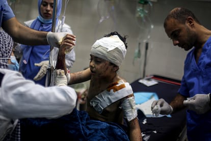 Un niño de 10 años recibe tratamiento médico por las heridas causadas por la ofensiva israelí, este jueves en la localidad de Khan Younis, en el sur de Gaza.