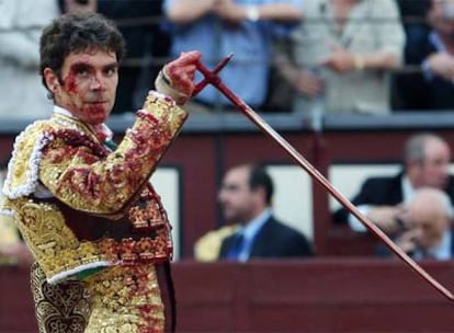 El torero sufrió tres cogidas en Ventas. "Llegó a la camilla con 70 pulsaciones, como si tal cosa, y deseaba volver al toro", dice su cirujano.