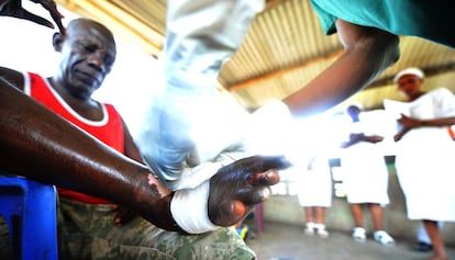 Un paciente de lepra es tratado en el  Hopital de la Rive de Kinshasa, en la República Democrática de Congo.  