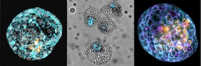 Modelos de embrião humano denominados iBlastoides, gerados no laboratório de José Polo.
