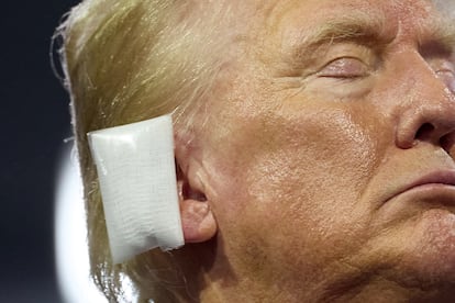 Detalle de la oreja vendada de Trump.