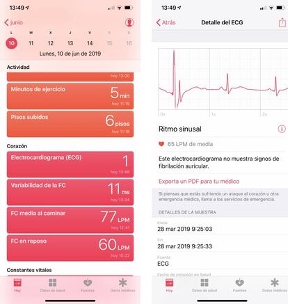 Electrocardiograma en Apple Watch Series 4