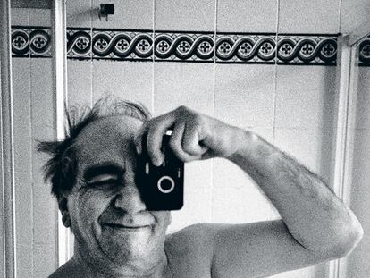 Autorretrato de Jordi Socías después de una operación de corazón