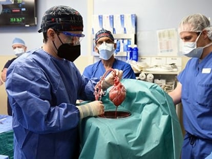 Científicos y médicos de la Facultad de Medicina de la Universidad de Maryland realizan el primer trasplante exitoso histórico de corazón porcino a un ser humano adulto con enfermedad cardíaca en etapa terminal
FACULTAD DE MEDICINA DE LA UNIVE
  (Foto de ARCHIVO)
01/01/1970