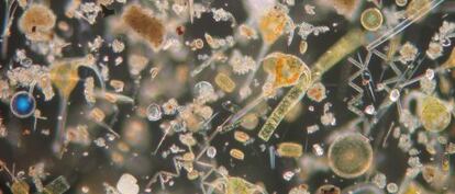 Plancton visto al microscopio.