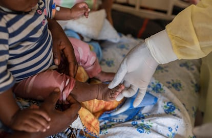 Una doctora revisaba el progreso de un niño infectado por mpox cerca de Goma, capital de Kivu Norte (RDC), el 19 de julio.