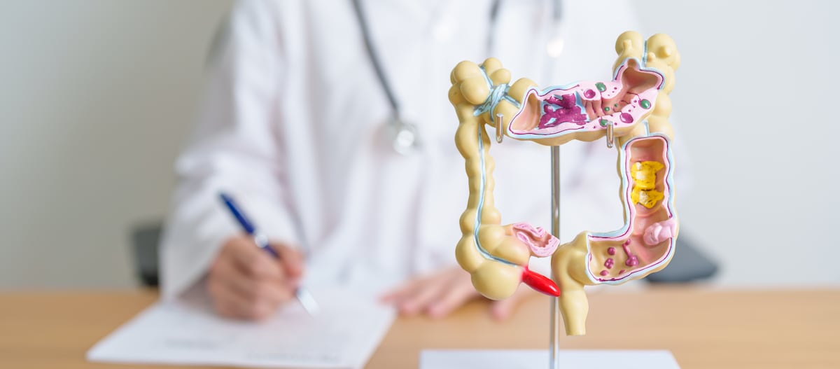 El cáncer colorrectal ya no solo se opera 