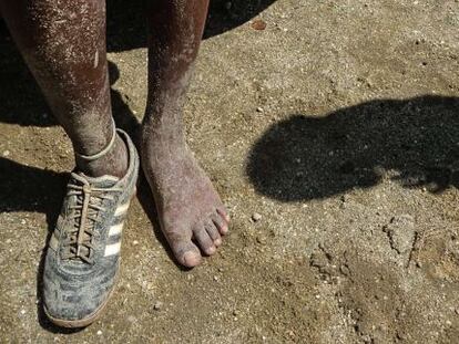 Un niño de la favela de Cidade de Deus calza un solo zapato.