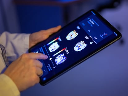 Un radiólogo en un hospital berlinés mira las imágenes del cerebro de un paciente a través de una 'app' basada en inteligencia artificial.