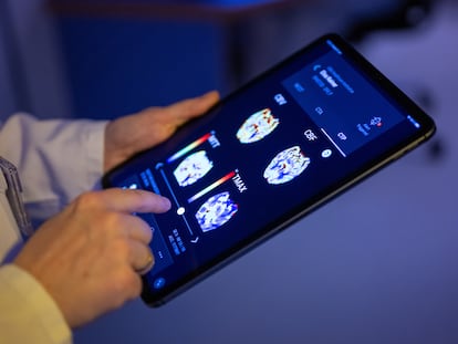 19 June 2023, Berlin: A radiologist at Unfallkrankenhaus Berlin looks at a patient's brain images in an AI-based app on a tablet. In order to care for stroke patients in acute situations even faster in the future, Unfallkrankenhaus Berlin wants to expand the use of artificial intelligence (AI). (to dpa: "Unfallkrankenhaus wants to improve patient care through AI") Photo: Monika Skolimowska/dpa (Photo by Monika Skolimowska/picture alliance via Getty Images)