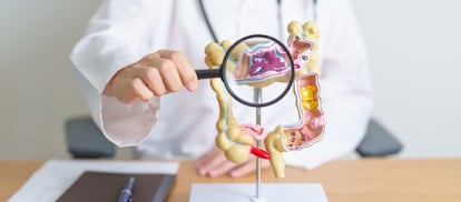 La enfermedad inflamatoria intestinal, que engloba tanto la enfermedad de Crohn como la colitis ulcerosa, afecta a un 1% de la población y suele diagnosticarse entre los 15 y los 30 años.