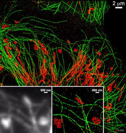 Imagen de microtúbulos de las células (en verde) y de la mitocondria (en rojo) realizada con el nuevo sistema de microscopía STORM del ICFO. Abajo, comparación entre la imagen tomada con un sistema convencional de fluorescencia (en gris) y el STORM.