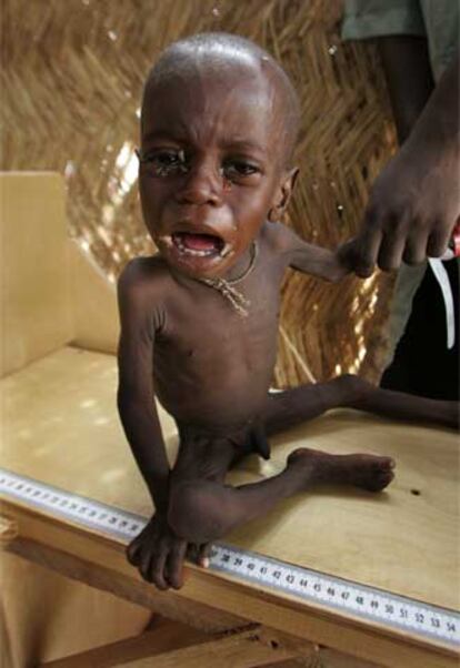 Un niño recibe ayuda en un centro de nutrición terapéutica en Níger.