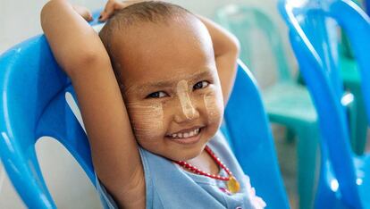 Un niño de Myanmar con VIH.
