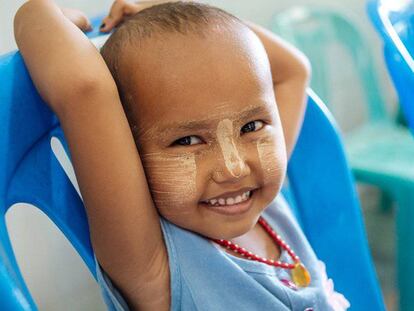 Un niño de Myanmar con VIH.